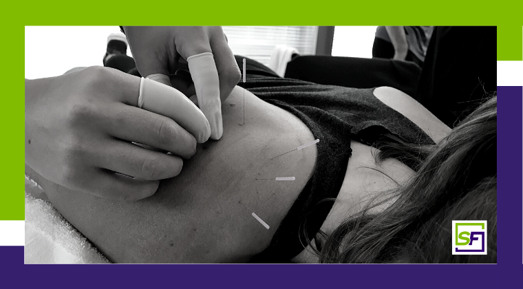 Dry Needling course for Recovery and Regeneration