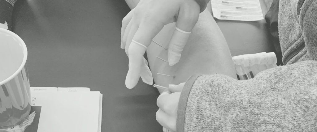 Functional Integrative Rehabilitation Education - E Stim and Needling