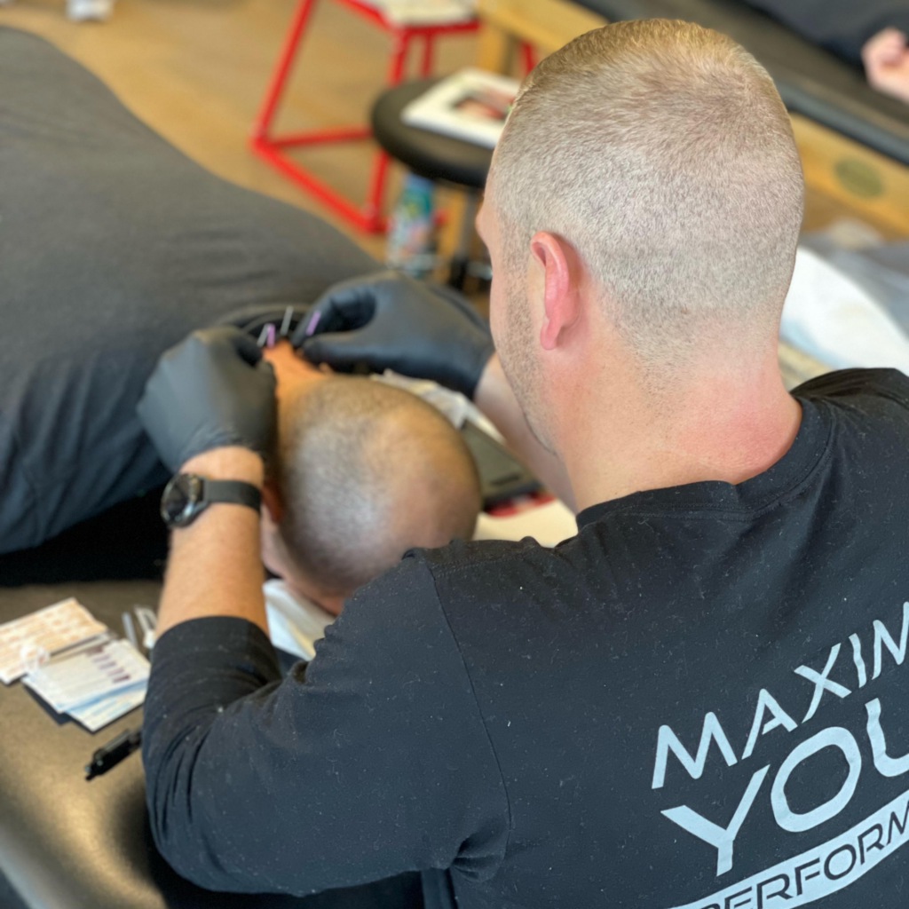 Top 6 mistakes clinicians make when using dry needling