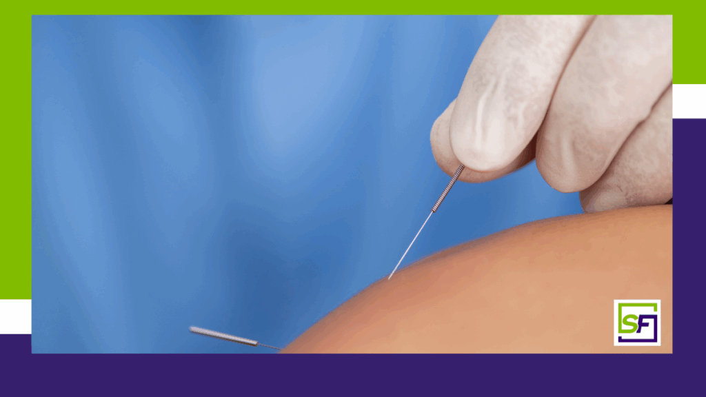 Dry Needling for Stroke